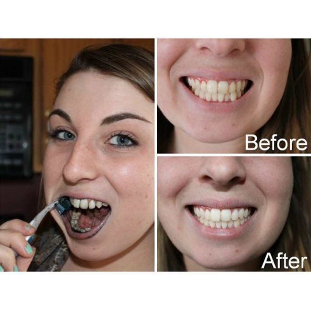Bambu kömür diş diş diş hekimi - Teeth Whitening Filter incelemesi ve fiyatı